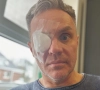 Peter Van de Veire doet iedereen schrikken met ooglapje om medische reden: “Is al vreselijk geweest”